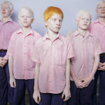 40 Blind Indian Albino Boys by Brent Stirton