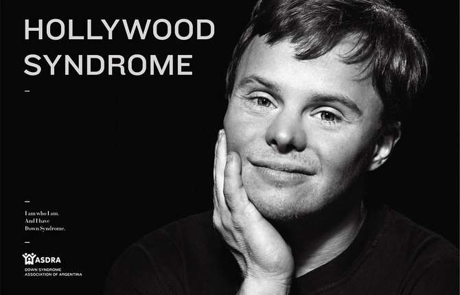 Down Syndrome Campaign by TBWA