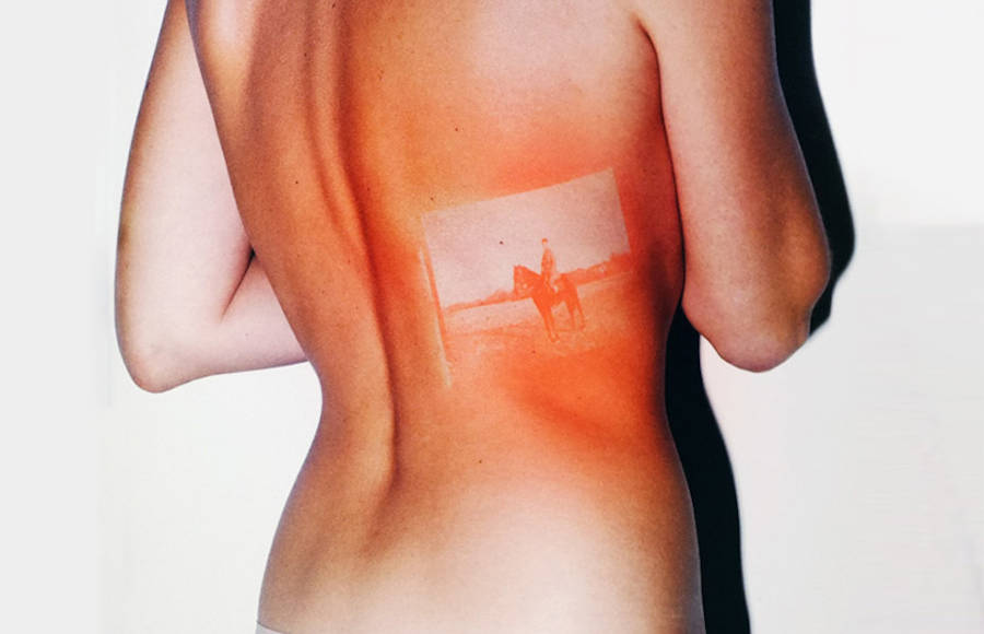 Sunburns Pictures Printed on Bodies