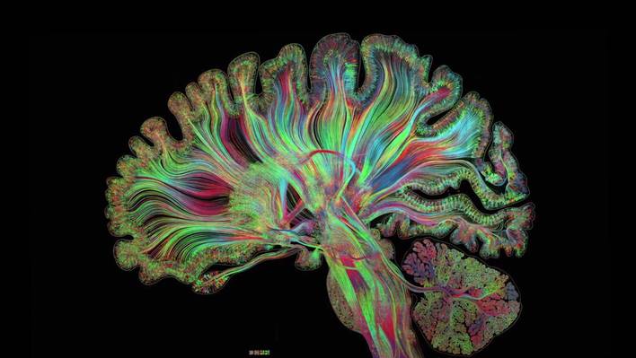 Intricate and Arty Brain Cross-Section