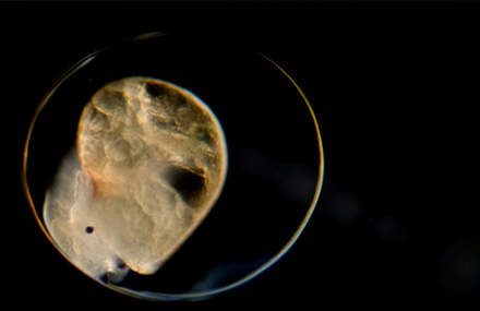 Microvida