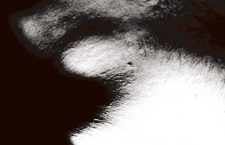Bipolar: between analogical and digital