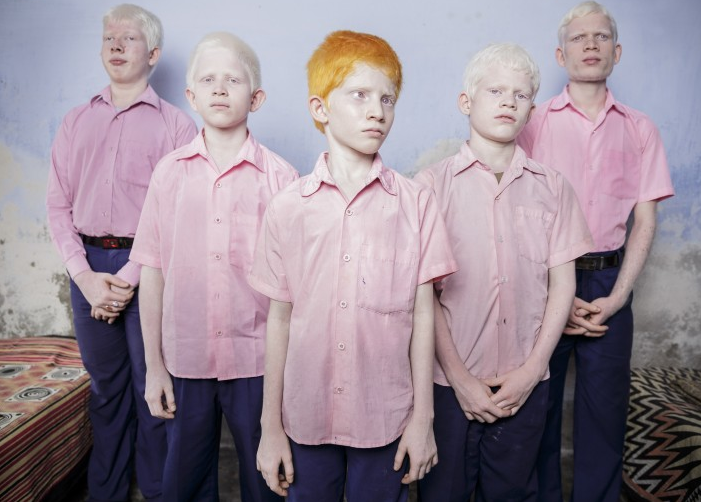 40 Blind Indian Albino Boys by Brent Stirton