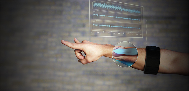 Gesture Control Armband_3