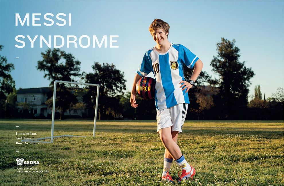 Down Syndrome Campaign by TBWA_4