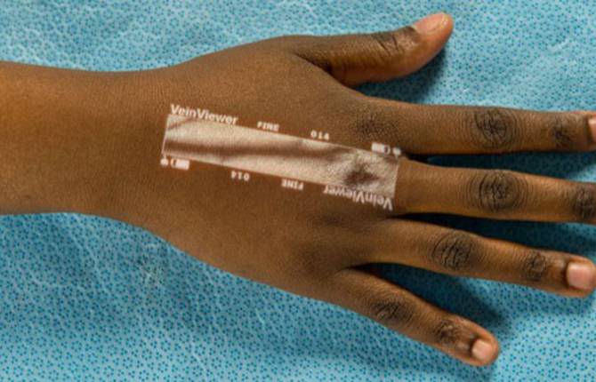 Veins Projected On Skin