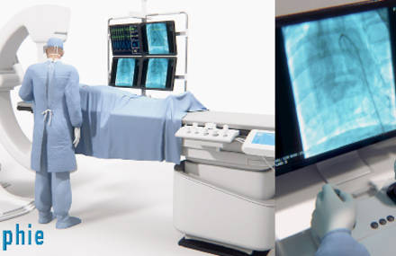 Angiographie
