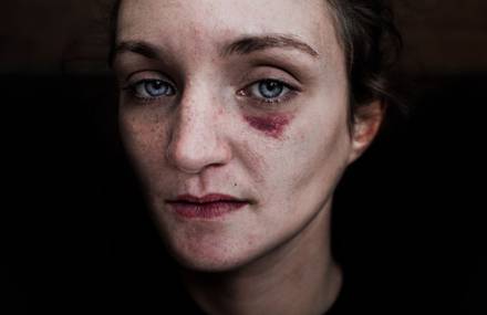 Homeless People Portraits Photography by Lee Jeffries