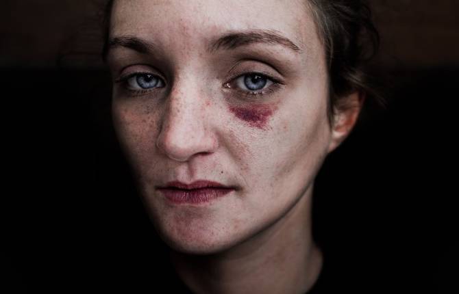 Homeless People Portraits Photography by Lee Jeffries