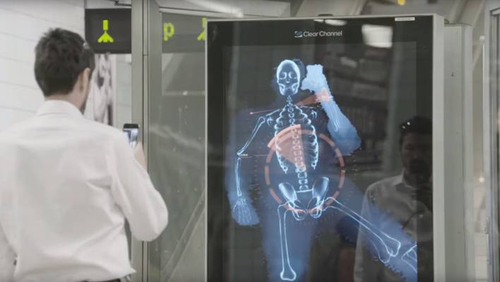 Real Time Posture Scanner