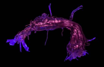 Stunning Microscopic Pictures from the Wellcome Image Awards 2017