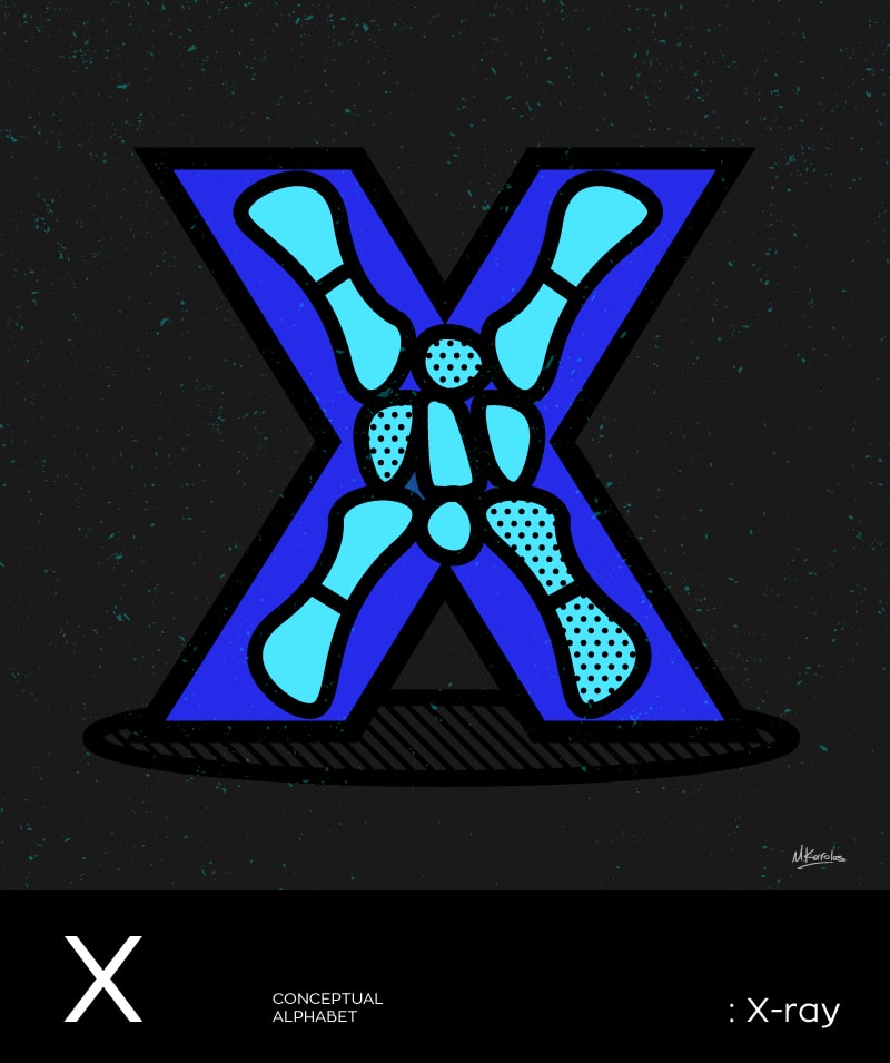 x