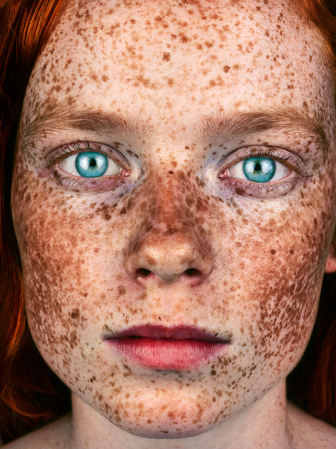 fubiz-FRECKLES_DAISY_TRINDER_BROCK_ELBANK_0041F-04