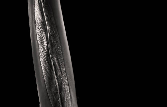 Inside The Human Body With Photographer Chan Dick